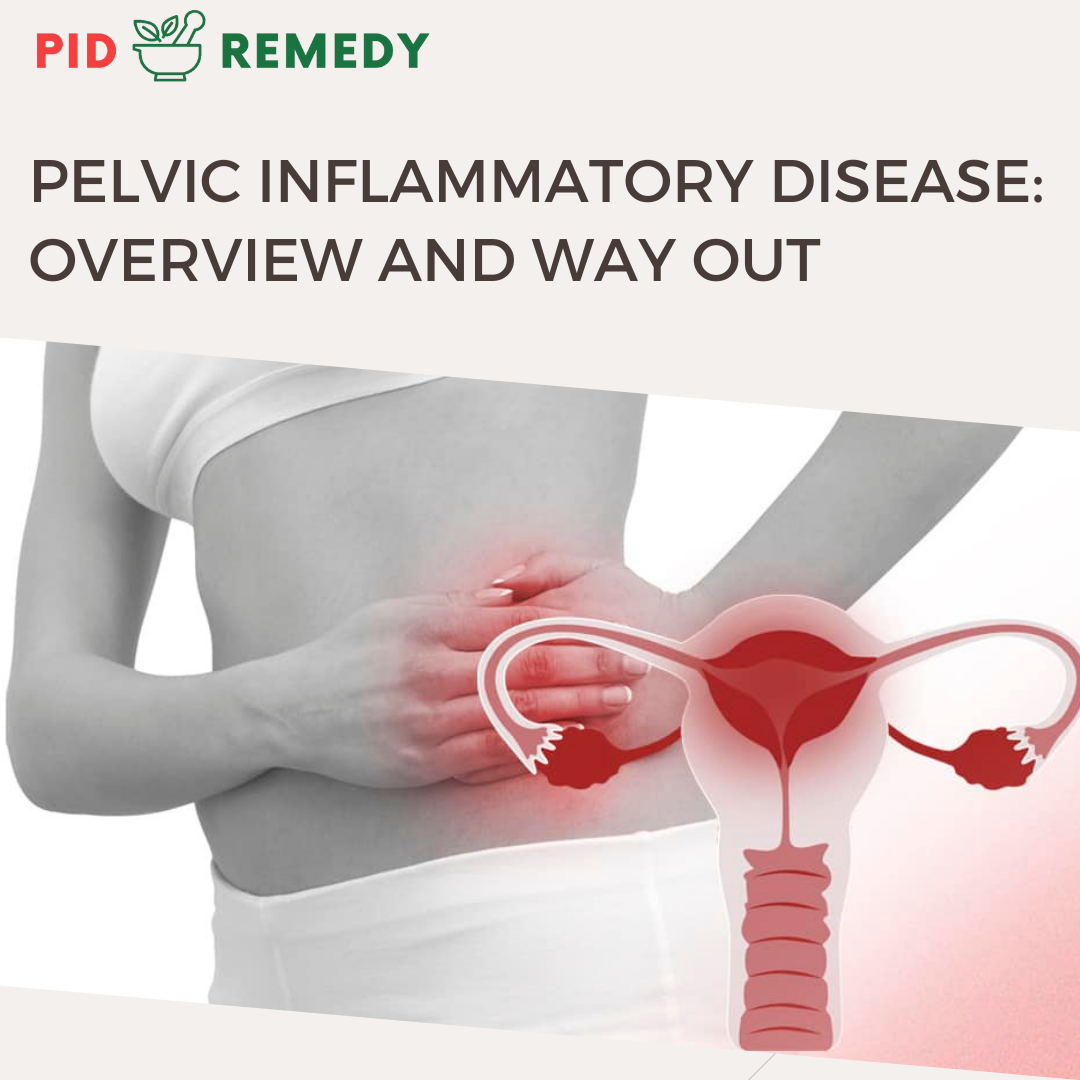 Pelvic Inflammatory Disease (PID): Overview and the Way Out
