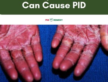 How Staph Infection Can Cause PID