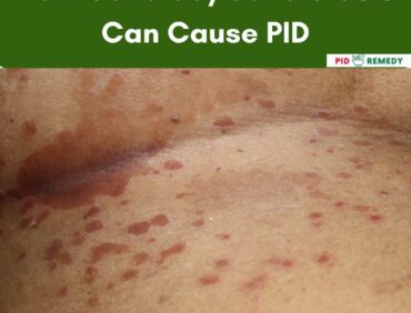 How Candida/Candidiasis Can Cause PID