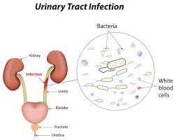 Illustration of the Urinary Tract